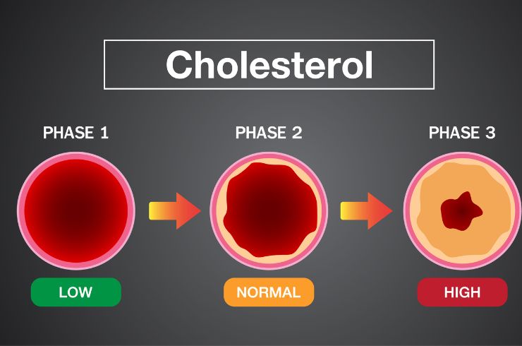 High Cholesterol