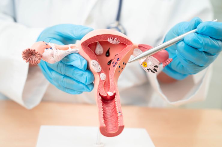 Endometritis