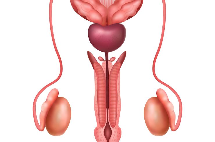 Varicocele